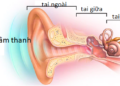 Cách làm cho tai nghe rõ hơn
